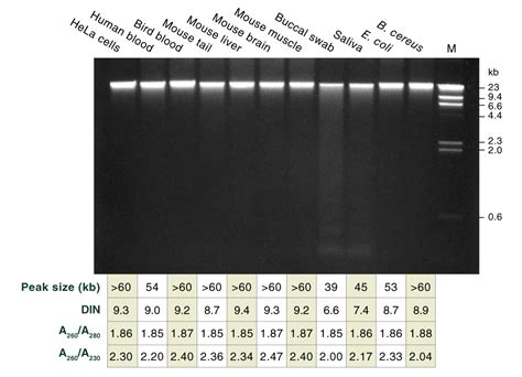 dna extraction and purification kit|Genomic DNA (gDNA) Extraction and Purification .